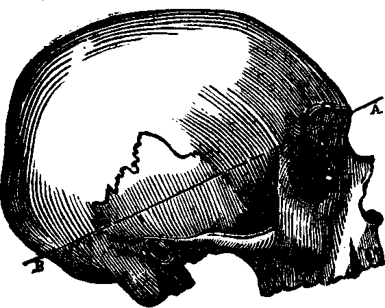 Illustration:
Fig. 88.