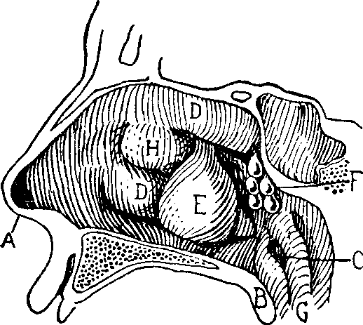 Illustration:
Fig. 13. NASAL POLYPI.