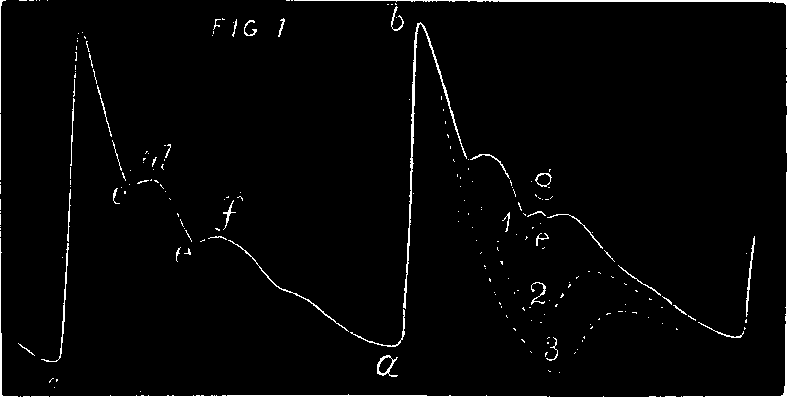 Illustration:
Fig. 2. The above is a representation of a tracing of a healthy pulse as
made with the Sphygmograph.