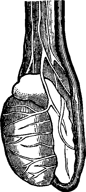 Illustration:
Fig. 1. A healthy testicle.