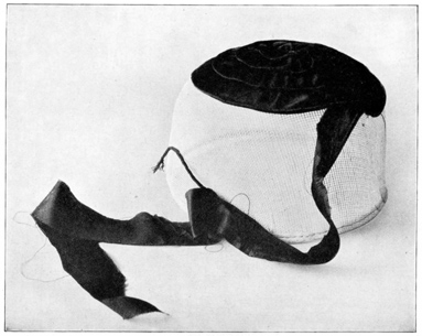 SHOWING METHOD OF COVERING CROWN WITH TWO-INCH WIDE BIAS
SATIN. CORD SEWED IN ONE EDGE; THE OTHER EDGE IS GATHERED AND PULLED UP
TO FIT CROWN