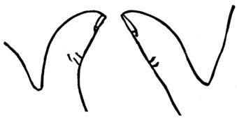 Fig. 2.&mdash;THE SUPPLE-JOINTED THUMB. Fig. 3.&mdash;THE FIRM-JOINTED THUMB. 
