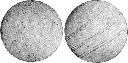 Transverse and longitudinal sections of cotton fibre.