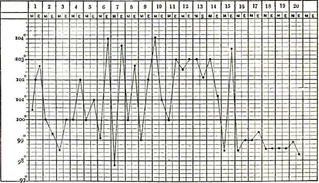 Typho-malarial fever part 2