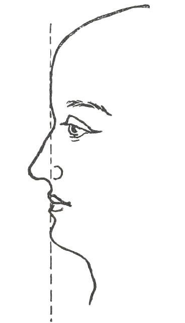 Fig. 20

CHIN STUDY